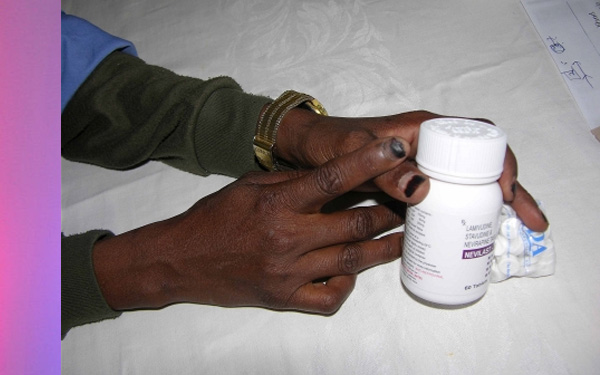 Photo: Casey Johnson/IRIN More treatment means fewer new infections